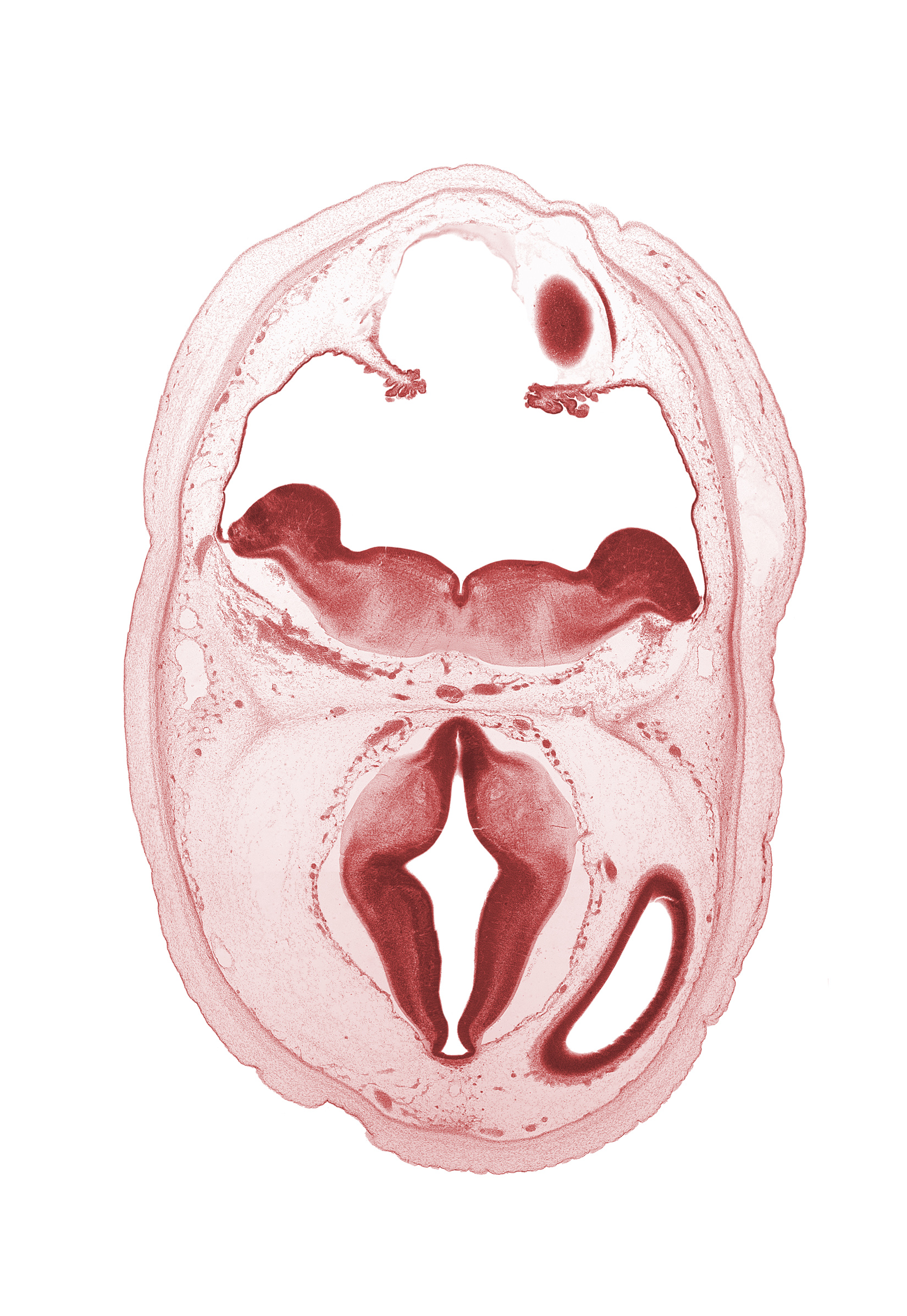 artifact separation(s), basilar artery, diverticulum of rhombencoel (fourth ventricle), dorsal thalamus, edge of alar plate of myelencephalon, hypothalamic sulcus, hypothalamus, lateral ventricle, metencephalon, oculomotor nerve (CN III), osteogenic layer, roof of diencephalon, subarachnoid space, sulcus dorsalis, third ventricle, trochlear nerve (CN IV)