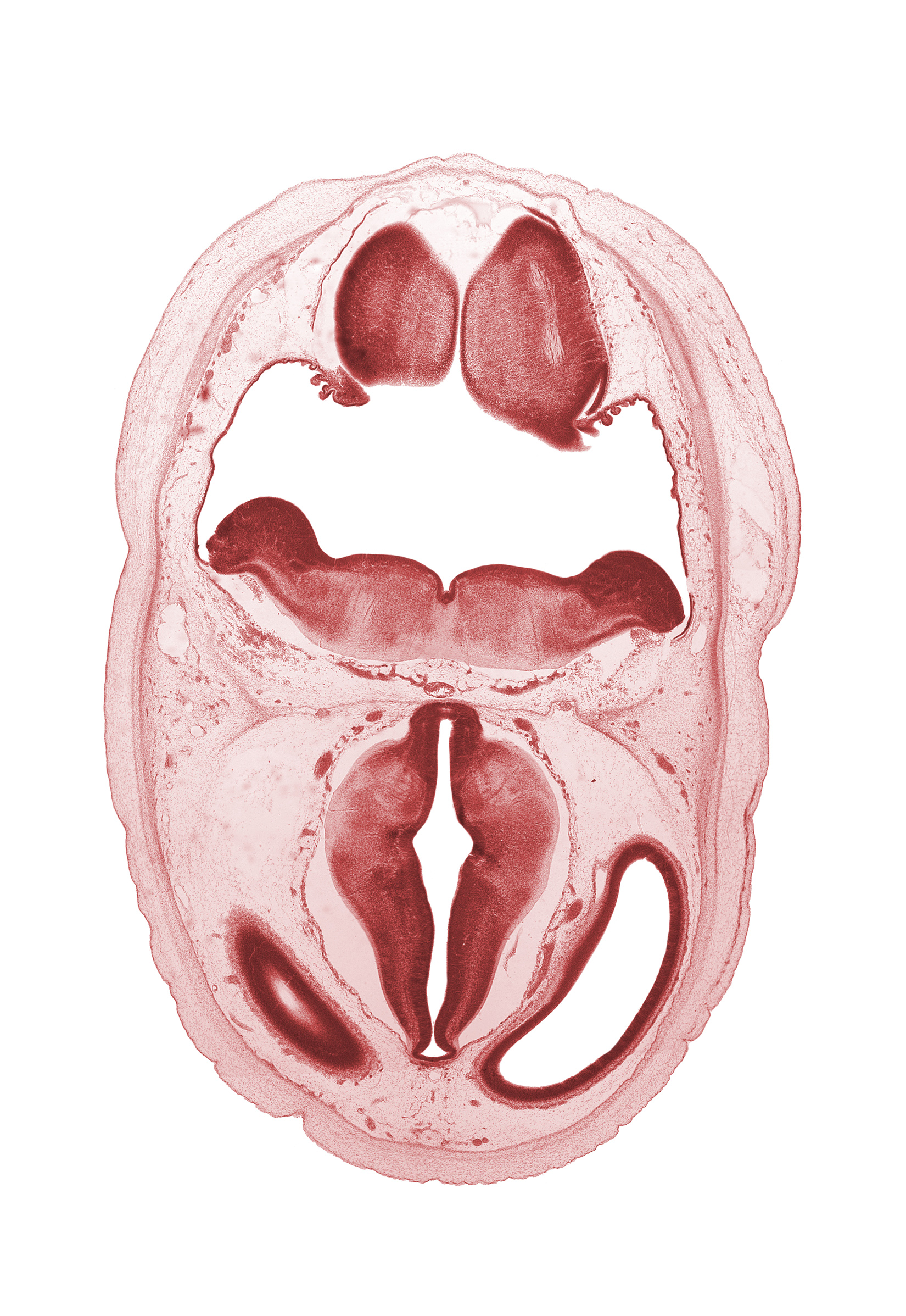 artifact separation(s), basilar artery, choroid fissure, dorsal thalamus, dural band for tentorium cerebelli, edge of lateral ventricle, hypothalamic sulcus, lateral ventricle, metencephalon, myelencephalon (medulla oblongata), osteogenic layer, posterior communicating artery, rhombencoel (fourth ventricle), subarachnoid space, zona limitans intrathalamica