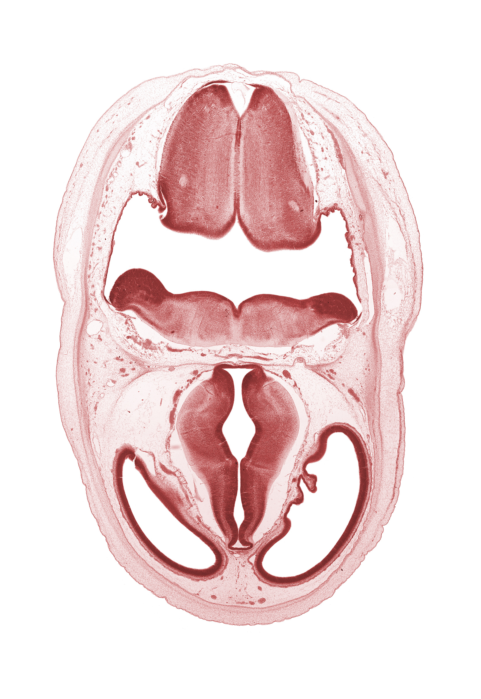 artifact separation(s), dural band for tentorium cerebelli, edge of choroid plexus, edge of endolymphatic duct, floor of diencephalon, lateral ventricle, oculomotor nerve (CN III), osteogenic layer, rhombencoel (fourth ventricle), roof of diencephalon, third ventricle, vascular plexus