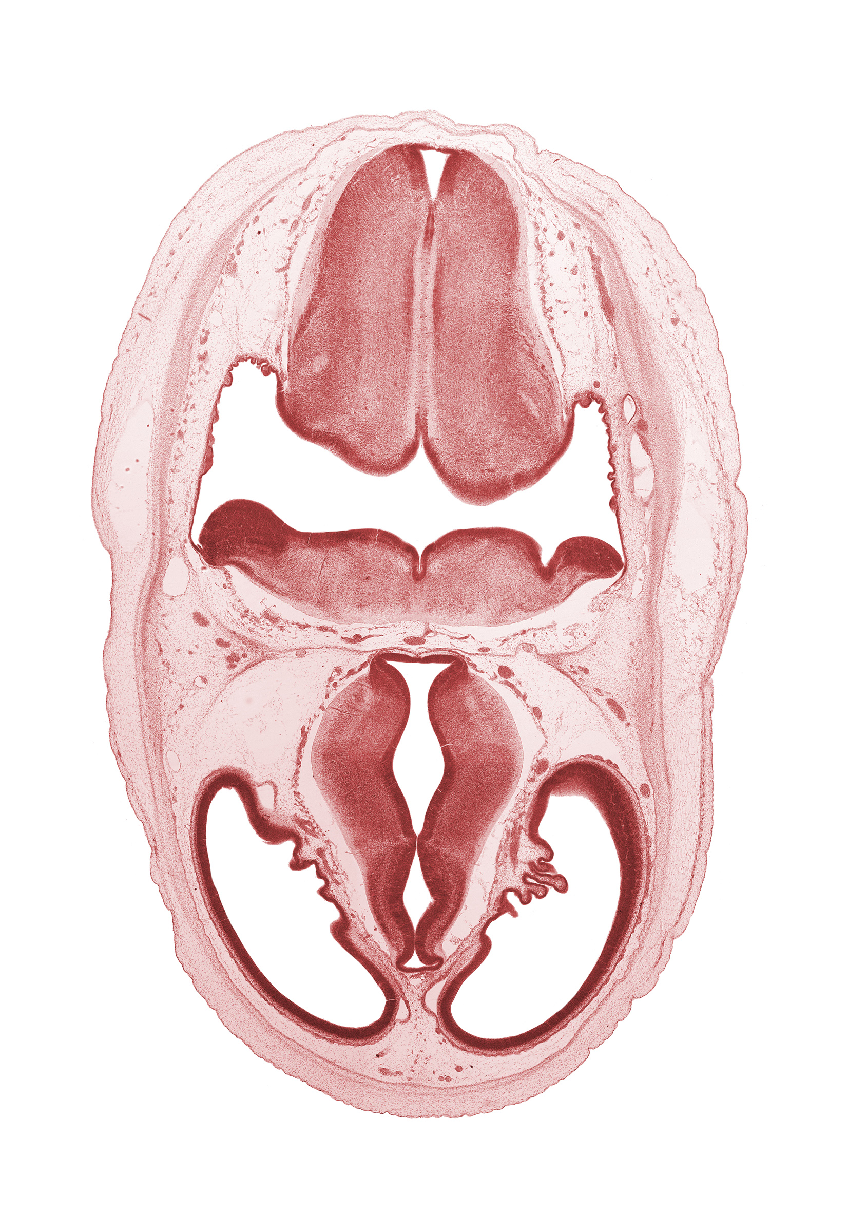 artifact separation(s), basilar artery, choroid plexus, endolymphatic sac, lateral ventricle, myelencephalon (medulla oblongata), obex, oculomotor nerve (CN III), pons region (metencephalon), rhombencoel (fourth ventricle), roof of rhombencoel (fourth ventricle), sensory decussation, trochlear nerve (CN IV), zona limitans intrathalamica