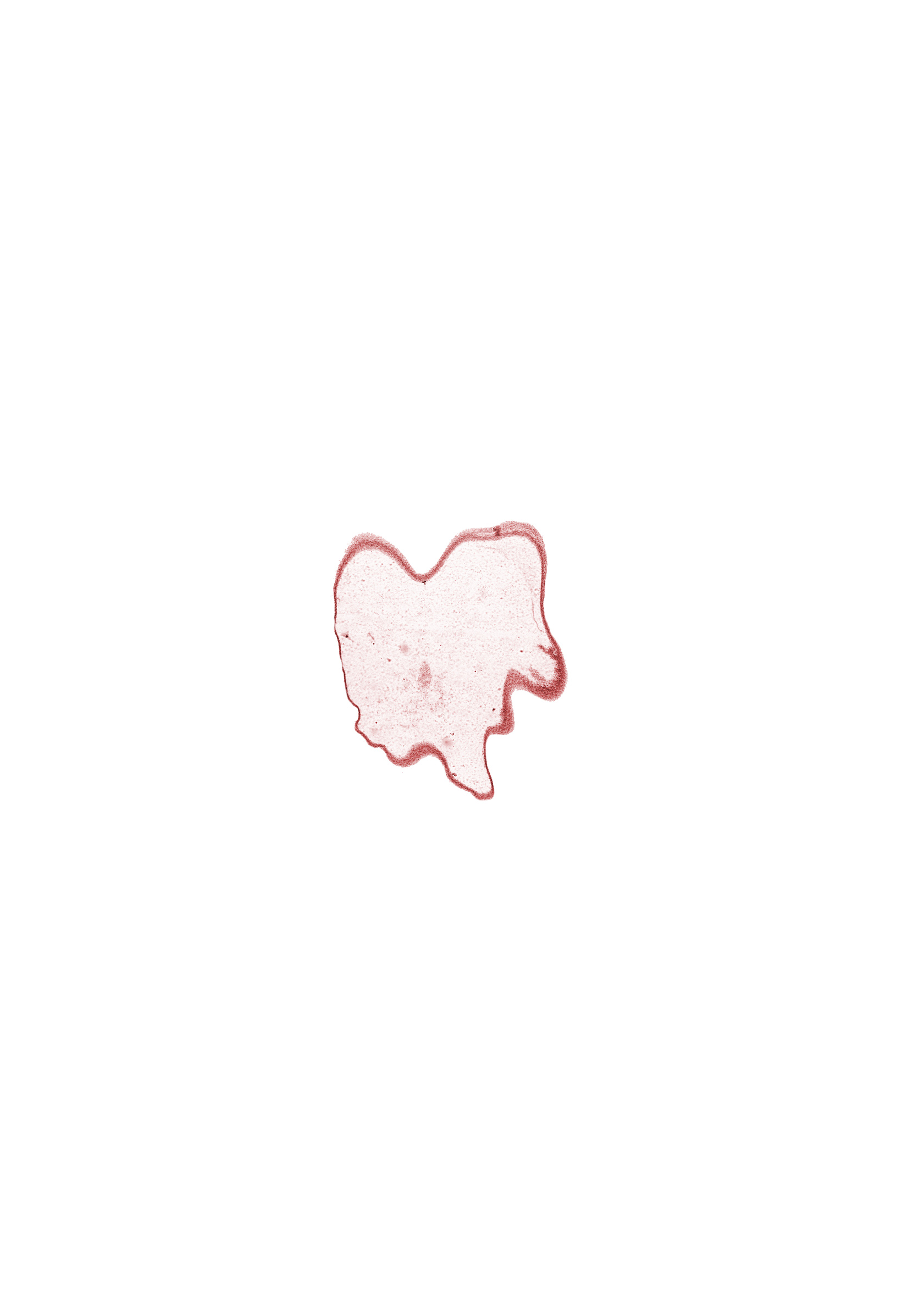 osteogenic layer, subarachnoid space, surface ectoderm