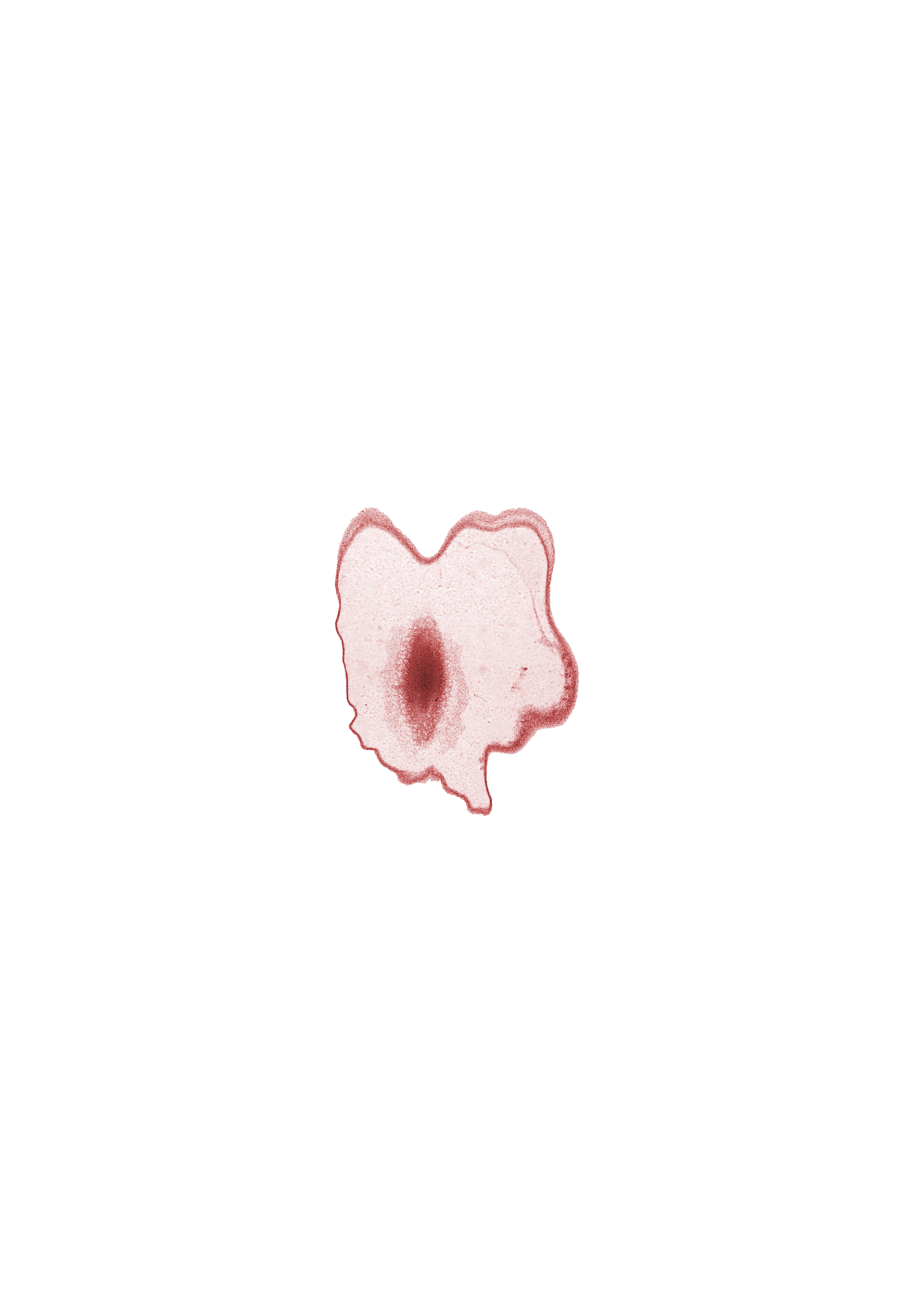 edge of mesencephalon, osteogenic layer, subarachnoid space