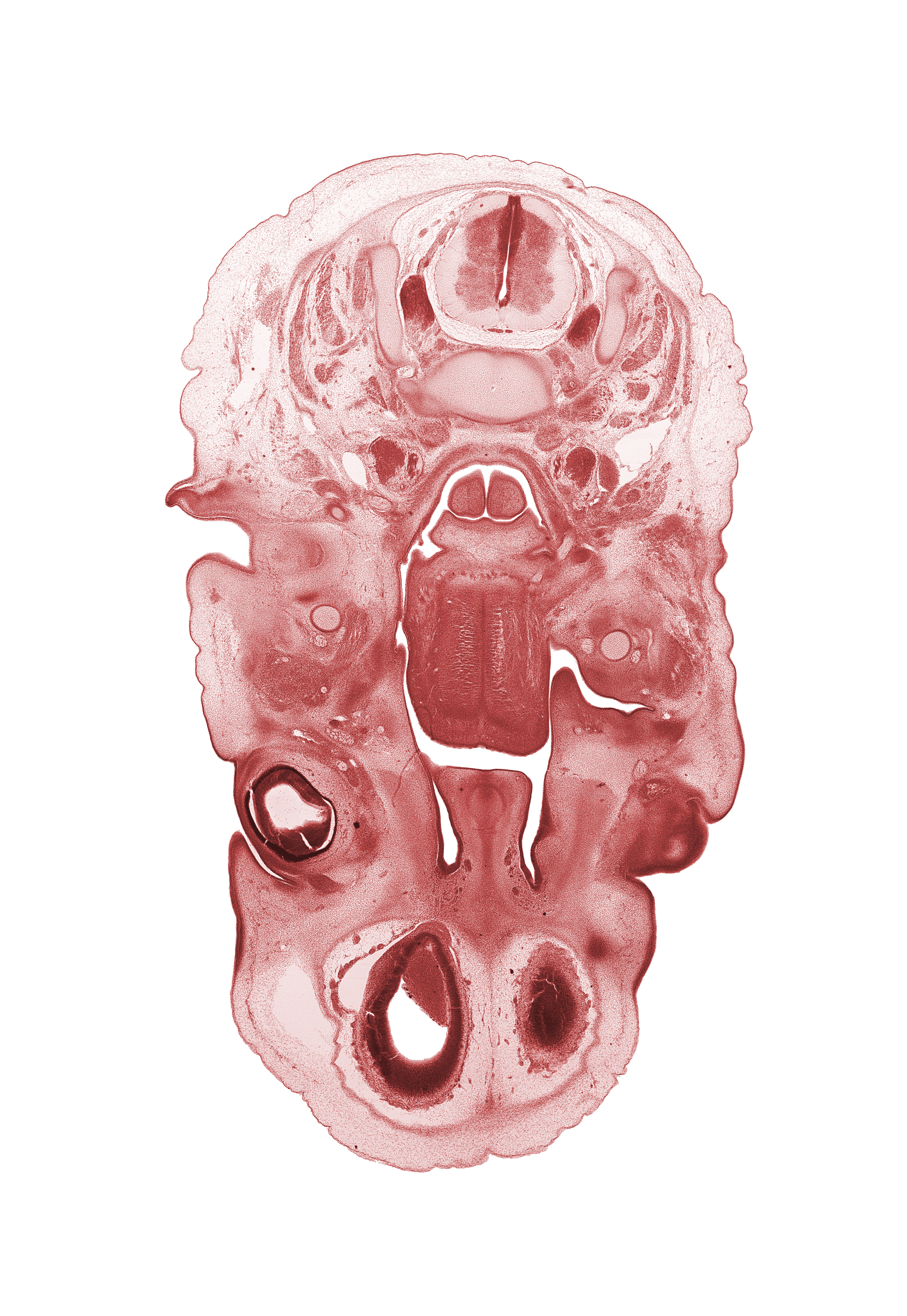 C-3 spinal ganglion, C-3 spinal nerve, auricle, blastema of extra-ocular muscle(s), choana, edge of cerebral vesicle(s), epiglottis, external acoustic meatus, glossopharyngeal nerve (CN IX), inferior ganglion of vagus nerve (CN X), internal jugular vein, lateral ventricle, lingual nerve, middle pharyngeal constrictor muscle, nasal cavity (nasal sac), olfactory bulb, palatine shelf, pharyngeal arch 1 cartilage (Meckel), retropharyngeal space, root of tongue, subarachnoid space