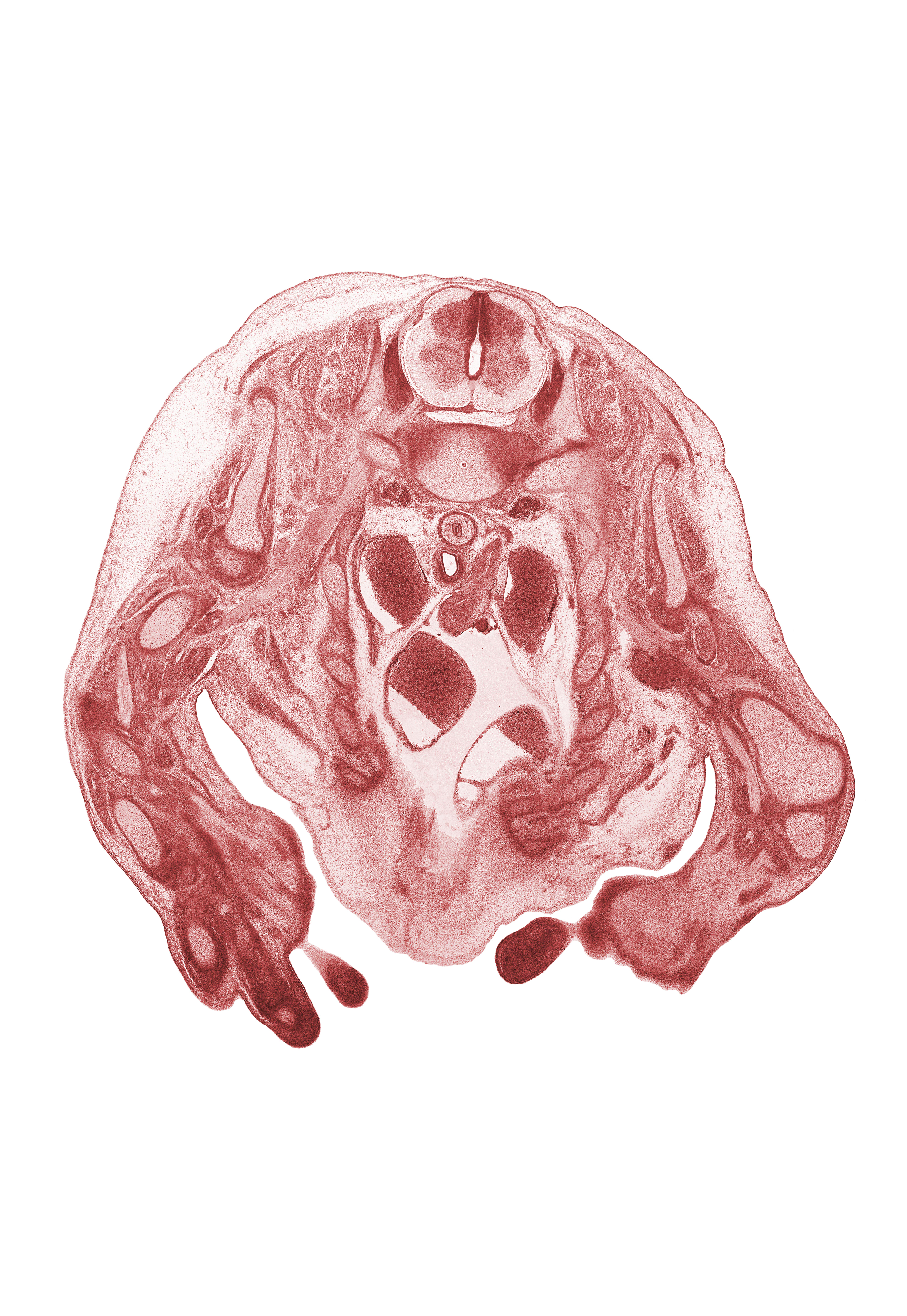 C-8 / T-1 intervertebral disc, C-8 spinal ganglion, central canal, cephalic edge of left atrium, dorsal funiculus, edge of left lobe of thymus gland, edge of mammary gland, head of rib 1, inferior cervical sympathetic ganglion, lateral funiculus, left subclavian artery, left vagus nerve (CN X), radius, rib 4, right atrium, right vagus nerve (CN X), scapula, shaft of humerus, shaft of rib 1, superior vena cava, trapezius muscle, ulna, ulnar nerve, ventral funiculus