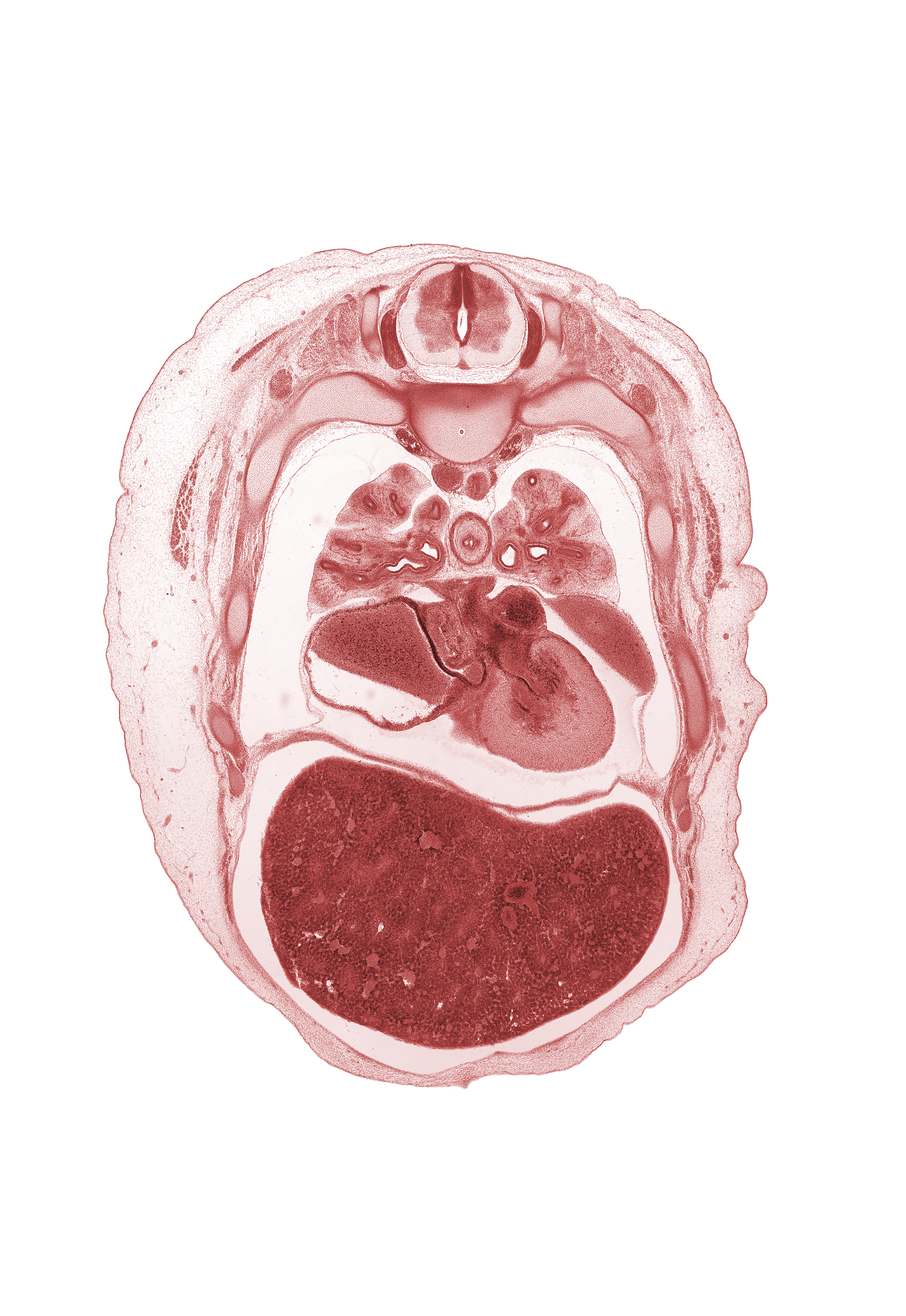 T-4 spinal ganglion, central canal, costovertebral joint, horizontal fissure, left atrium, left pulmonary vein, left ventricle, lower secondary bronchus, medial segmental bronchus, middle lobe of right lung, middle secondary bronchus, muscular layer of esophagus, oblique fissure, pericardial cavity, peritoneal cavity, phrenic nerve, rib 5, rib 6, rib 7, right pulmonary vein, upper lobe of left lung, upper lobe of right lung