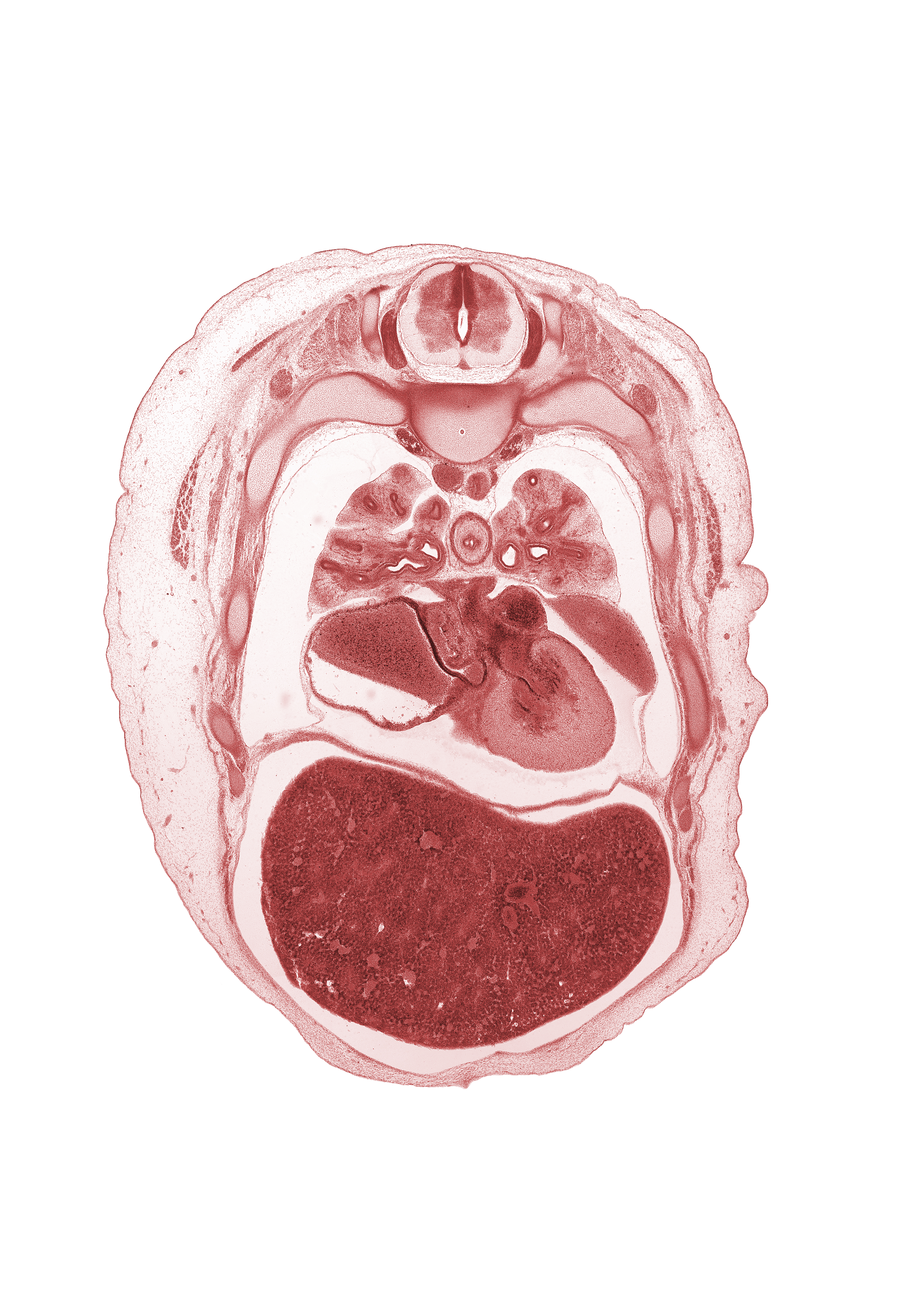 T-4 spinal ganglion, central canal, costovertebral joint, horizontal fissure, left atrium, left pulmonary vein, left ventricle, lower secondary bronchus, medial segmental bronchus, middle lobe of right lung, middle secondary bronchus, muscular layer of esophagus, oblique fissure, pericardial cavity, peritoneal cavity, phrenic nerve, rib 5, rib 6, rib 7, right pulmonary vein, upper lobe of left lung, upper lobe of right lung