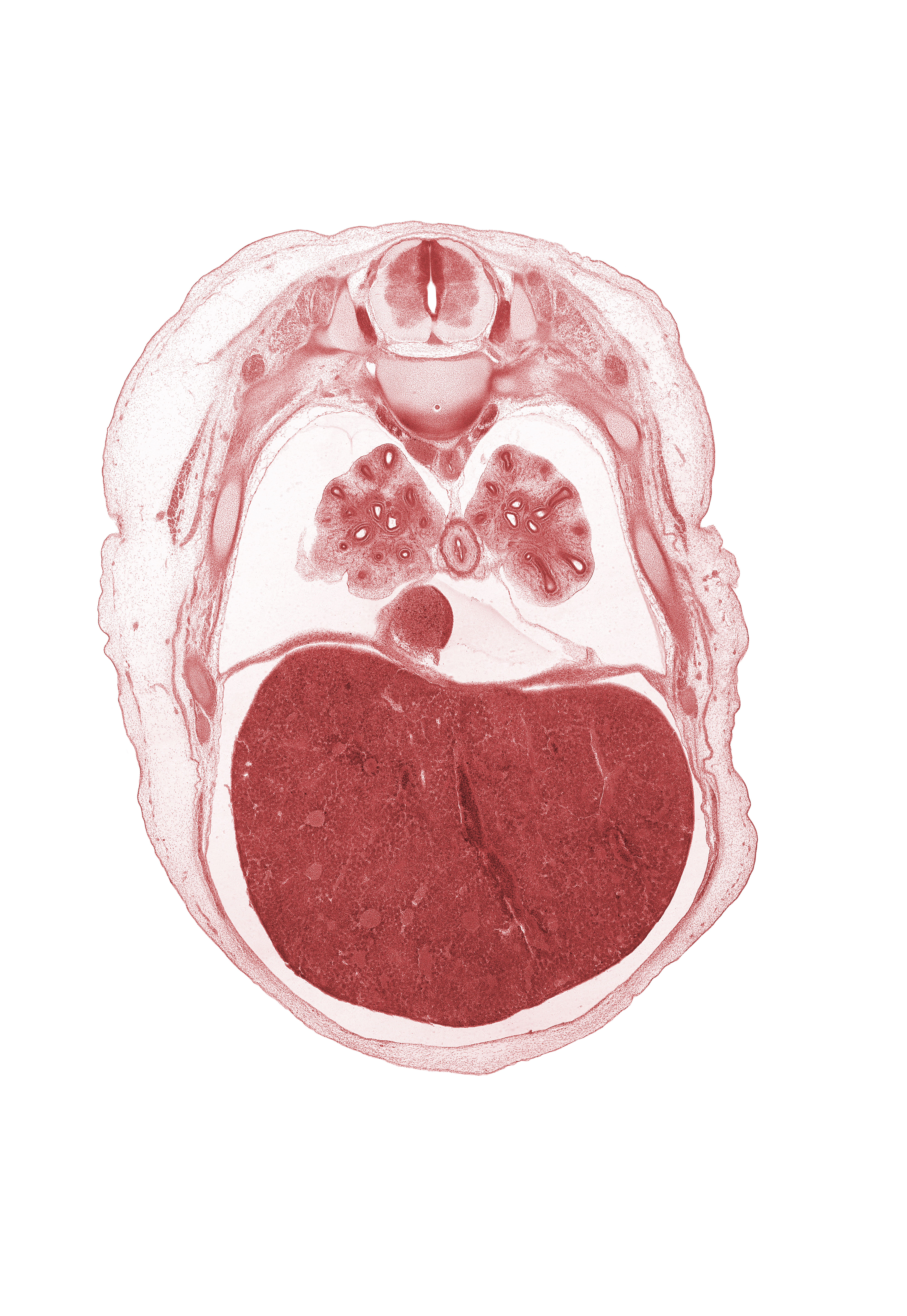 T-6 spinal ganglion, T-6 spinal nerve, dorsal horn of grey matter, intercostal muscle(s), lateral horn of grey matter, left lobe of liver, liver prominence, lower lobe of right lung, muscular part of diaphragm, pericardial cavity, peritoneal cavity, pleural cavity, rib 7, rib 8, right lobe of liver, sympathetic trunk, ventral horn of grey matter