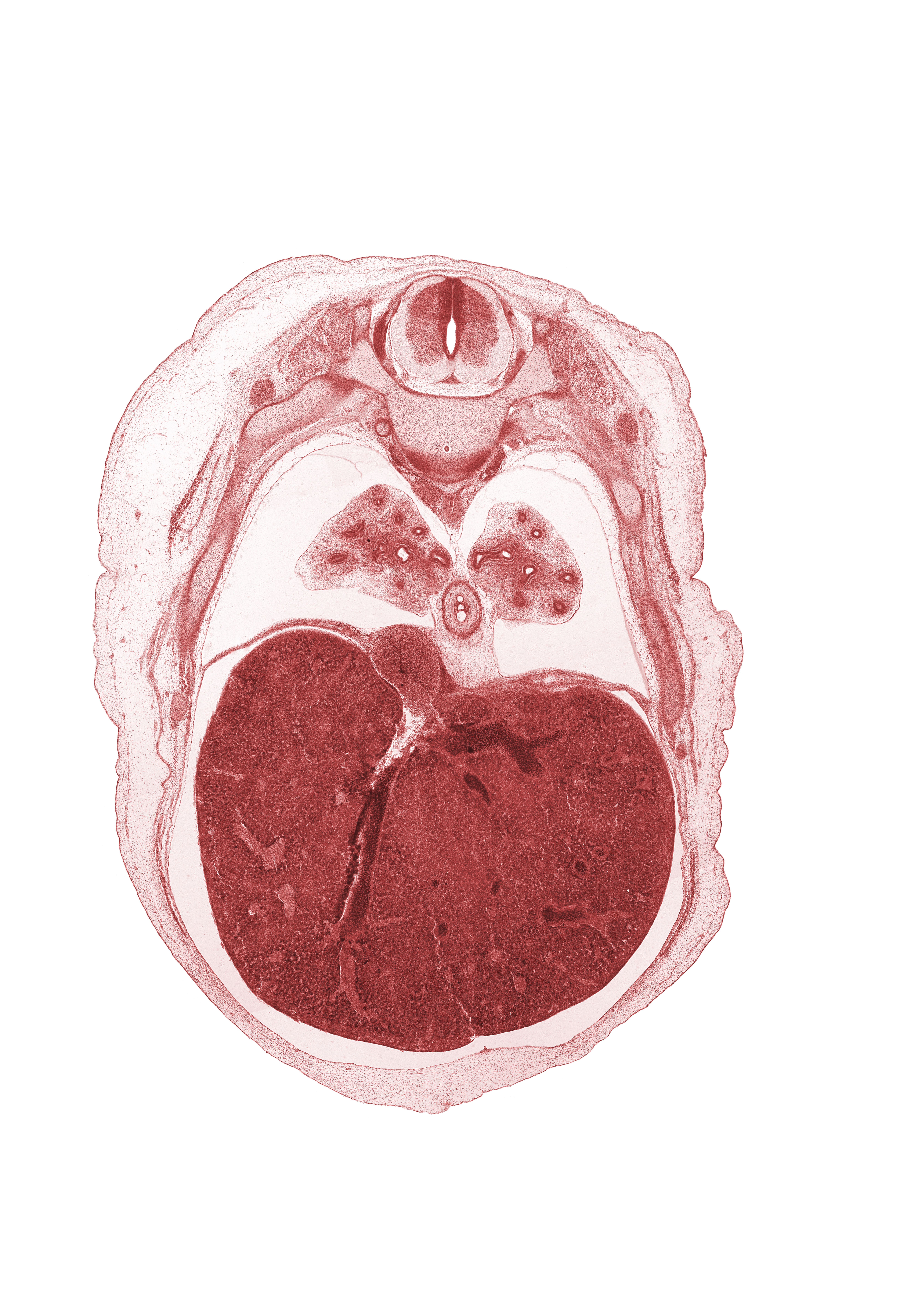 T-7 spinal ganglion, T-7 spinal nerve, efferent hepatic vein, inferior vena cava, intermediate zone, junction of hepatic veins and inferior vena cava, left lobe of liver, lower lobe of left lung, lower lobe of right lung, marginal zone, peritoneal cavity, pleural recess, posterior intercostal artery, pulmogenic coat, pulmonary ligament, rib 8, sympathetic trunk, ventricular zone
