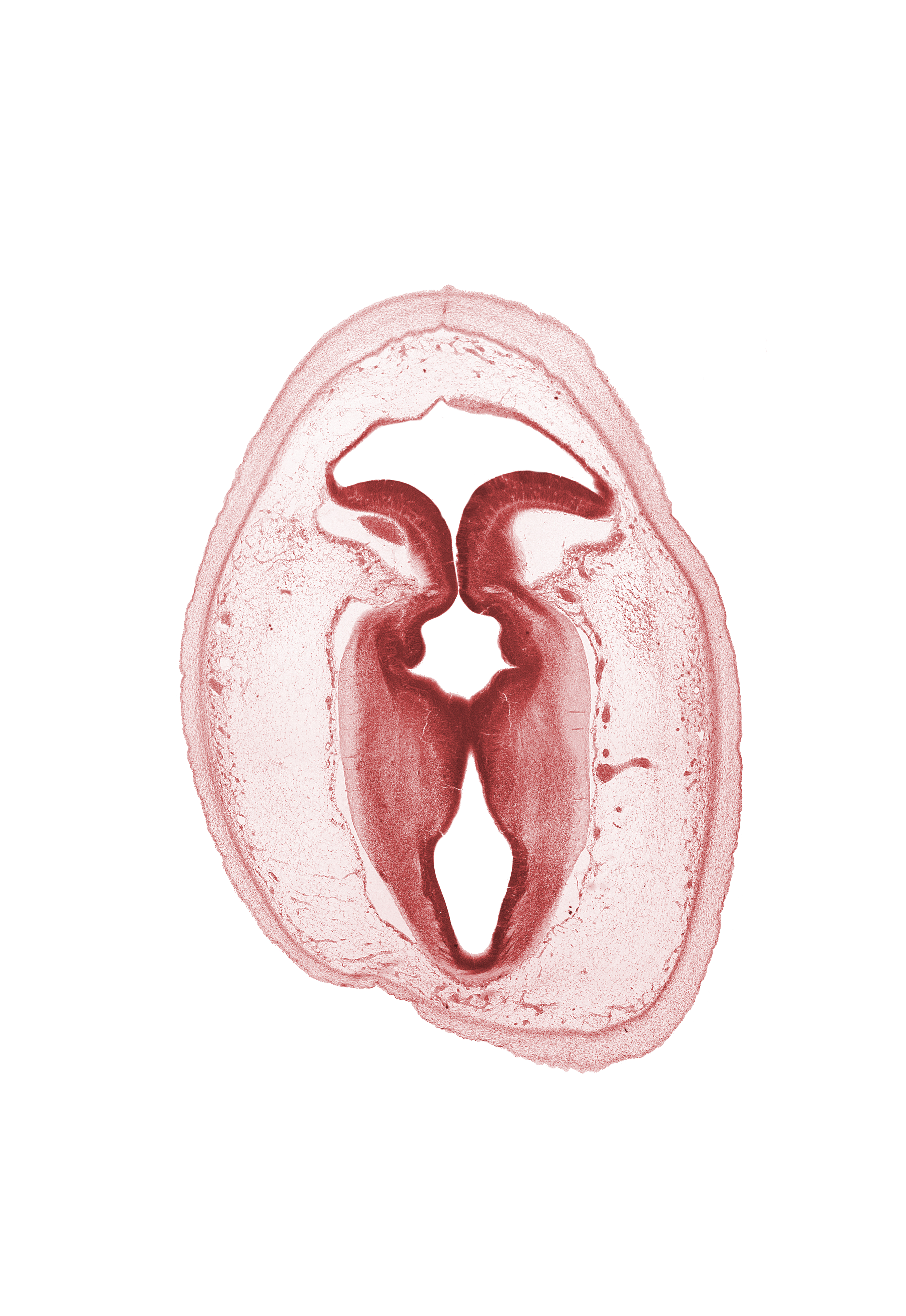 artifact separation(s), cerebral aqueduct (mesocoele), commissure of superior colliculus, junction of cerebral aqueduct and rhombencoel (fourth ventricle), loose connective tissue, osteogenic layer, rhombencoel (fourth ventricle), root of trochlear nerve (CN IV), subarachnoid space, surface ectoderm, vascular plexus