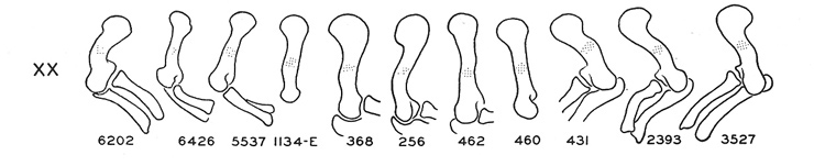 Progression of the humerus spanning two days