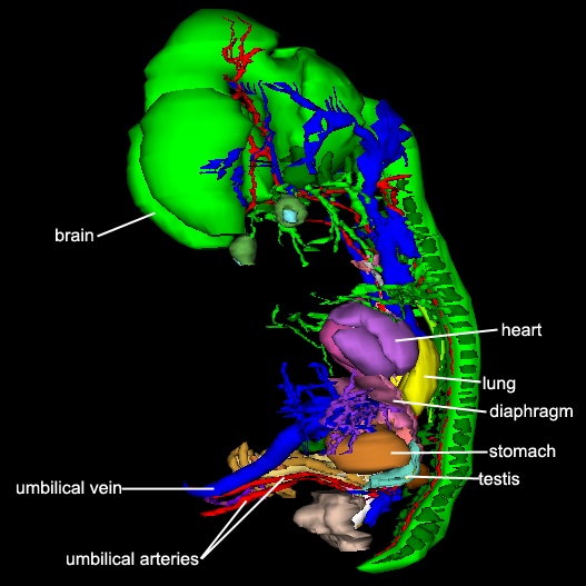 Organs - Right Lateral Liver Removed