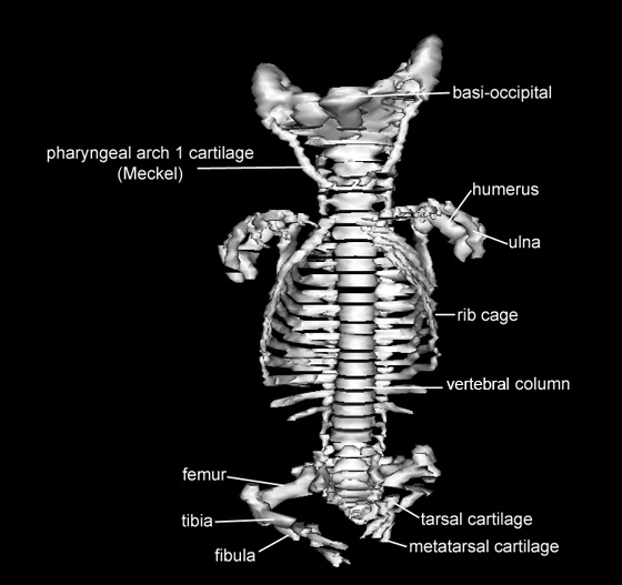 Skeleton - Anterior