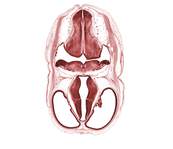 alar plate(s), basal plate, decussation in floor plate of myelencephalon, dorsal thalamus, edge of endolymphatic sac, exoccipital, hypothalamic sulcus, hypothalamus, osteogenic layer, pontine flexure region, roof plate, root of vagus nerve (CN X), stem of posterior dural venous plexus, subarachnoid space, sulcus dorsalis, sulcus medius, third ventricle, ventral thalamus