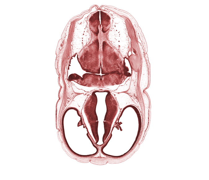 artifact space(s), basilar artery, choroid plexus, decussation in floor plate of myelencephalon, dorsal thalamus, endolymphatic duct, exoccipital, glossopharyngeal nerve (CN IX), hypothalamus, lateral recess of rhombencoel (fourth ventricle), lateral ventricle, median sulcus, otic capsule cartilage, posterior communicating artery, root of vagus nerve (CN X), sigmoid sinus, subarachnoid space, sulcus limitans, third ventricle, venous plexus(es), ventral thalamus