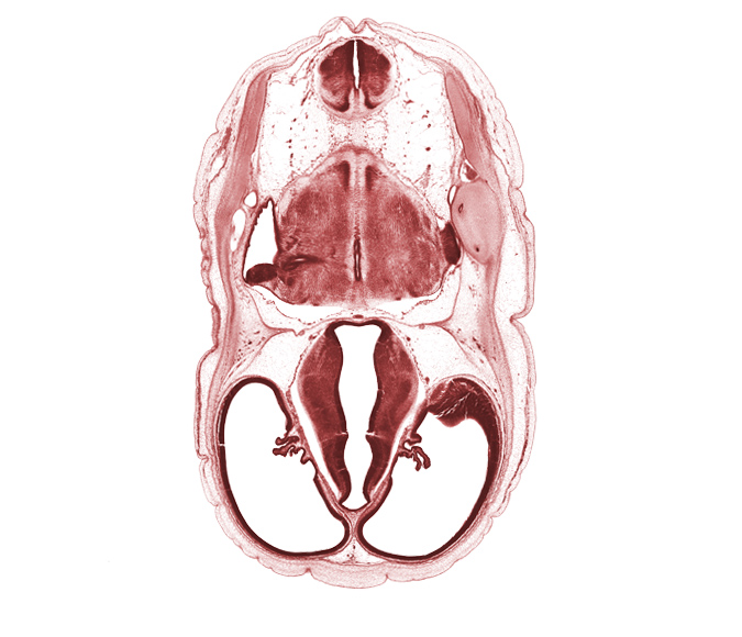 artifact space(s), basilar artery, choroid plexus, endolymphatic sac, exoccipital, hypothalamic sulcus, hypothalamus, lateral ventricular eminence (telencephalon), otic capsule cartilage, posterior communicating artery, posterior semicircular duct, region of cervical flexure, sigmoid sinus, subarachnoid space, sulcus medius, vascular plexus