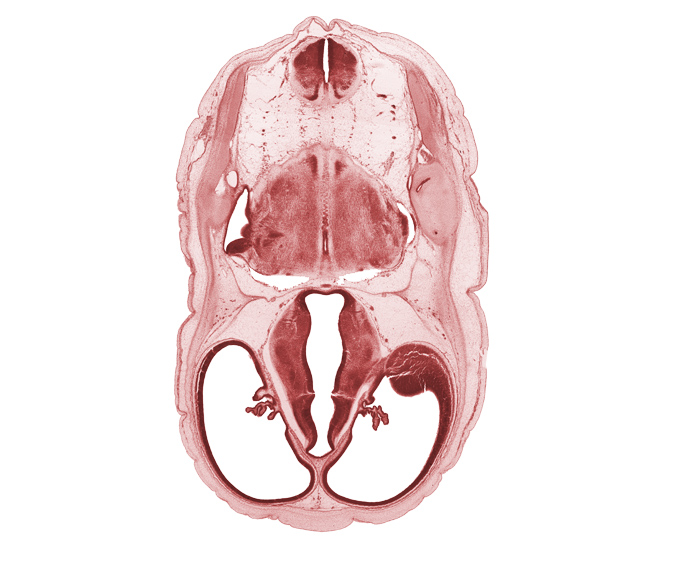 cerebral vesicle (hemisphere), decussation, dorsal thalamus, dural band for tentorium cerebelli, endolymphatic duct, glossopharyngeal nerve (CN IX), hypothalamus, lateral ventricle, lateral ventricular eminence (telencephalon), marginal ridge, median sulcus, myelencephalon, posterior semicircular duct, root of hypoglossal nerve (CN XII), subarachnoid space, ventral thalamus