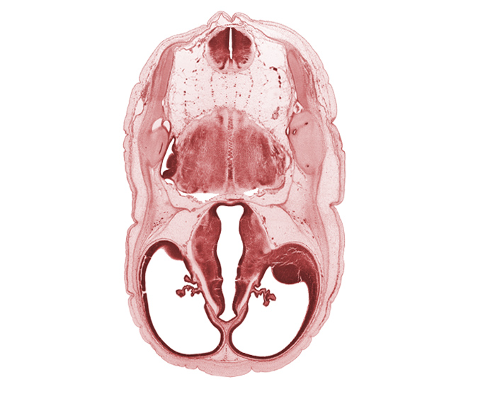 artifact fracture(s), basilar artery, cerebral vesicle (hemisphere), common crus, edge of anterior semicircular duct, endolymphatic duct, exoccipital, floor plate of diencephalon, glossopharyngeal nerve (CN IX), hypothalamus, lateral recess of rhombencoel (fourth ventricle), lateral semicircular duct, lateral ventricle, lateral ventricular eminence (telencephalon), oculomotor nerve (CN III), posterior communicating artery, posterior semicircular duct, roof plate of diencephalon, root of hypoglossal nerve (CN XII), root of vagus nerve (CN X), third ventricle, trochlear nerve (CN IV)