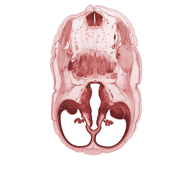 anterior semicircular duct, central canal, choroid plexus, common crus, decussation, diencephalon fiber tract, dorsal thalamus, endolymphatic duct, hypothalamic sulcus, hypothalamus, junction of brain and spinal cord, lateral ventricle, otic capsule cartilage, roof plate of diencephalon, root of hypoglossal nerve (CN XII), sigmoid sinus, subarachnoid space, sulcus dorsalis, third ventricle, ventral thalamus, zona limitans intrathalamica