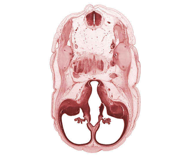 accessory nerve (CN XI), anterior semicircular duct, basilar artery, cerebral vesicle (hemisphere), common crus, edge of interventricular foramen, facial nerve (CN VII), glossopharyngeal nerve (CN IX), lateral ventricle, lateral ventricular eminence (telencephalon), posterior communicating artery, posterior semicircular duct, third ventricle, vagus nerve (CN X), vestibulocochlear nerve (CN VIII)