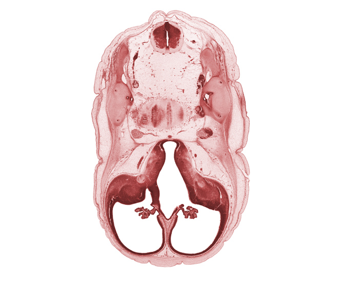 accessory nerve (CN XI), anterior semicircular duct, basilar artery, choroid plexus, decussation, endolymphatic duct, falx cerebri region, hypothalamus, interventricular foramen, lateral ventricle, posterior communicating artery, posterior semicircular duct, primordial cortical plate, sigmoid sinus, superior ganglion of vagus nerve (CN X), third ventricle, utricle, venous plexus(es)