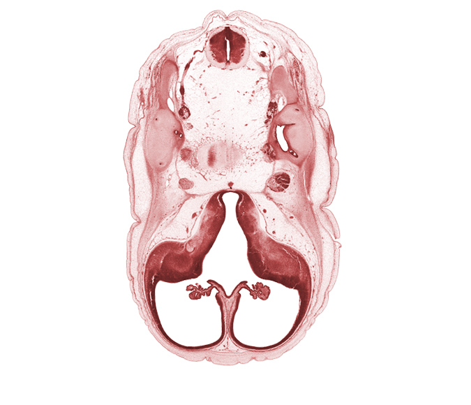 C-1 spinal ganglion, C-1 ventral root, accessory nerve (CN XI), basilar artery, central canal of spinal cord, cerebral vesicle (hemisphere), edge of pons region (metencephalon), facial nerve (CN VII), hypothalamus, lateral ventricle, otic capsule cartilage, posterior communicating artery, primordial cortical plate, roof plate of diencephalon, subarachnoid space, superior ganglion of glossopharyngeal nerve (CN IX), superior ganglion of vagus nerve (CN X), third ventricle, trigeminal ganglion (CN V), vestibulocochlear ganglion (CN VIII)