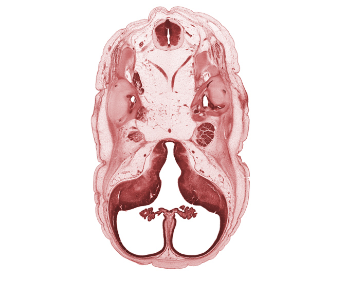 anterior semicircular duct, artifact separation(s), basilar artery, central canal, cephalic edge of auricle, corpus striatum, exoccipital, facial nerve (CN VII), glossopharyngeal nerve (CN IX), hypoglossal nerve (CN XII), lateral ventricular eminence (telencephalon), medial ventricular eminence (diencephalon), posterior communicating artery, posterior semicircular duct, subarachnoid space, trigeminal ganglion (CN V), utricle, vagus nerve (CN X), vertebral artery, vestibulocochlear ganglion (CN VIII)