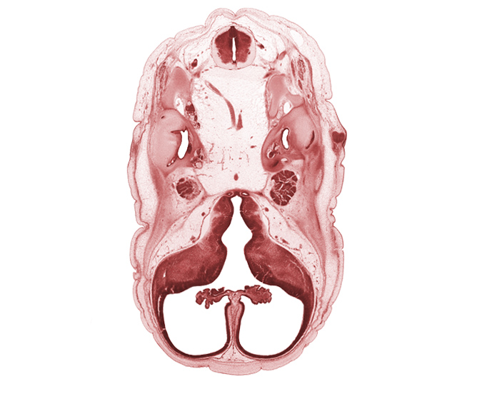 C-1 spinal nerve, anterior semicircular duct, artifact separation(s), basilar artery, choroid plexus, facial nerve (CN VII), hypothalamic sulcus, hypothalamus, interventricular foramen, junction of basilar artery and vertebral arteries, lateral semicircular duct, lateral ventricle, lateral ventricular eminence (telencephalon), medial ventricular eminence (diencephalon), motor root of trigeminal nerve (CN V), neurohypophysis, osteogenic layer, posterior semicircular duct, saccule(s), sigmoid sinus, spinal accessory nerve (CN XI), subarachnoid space, third ventricle, tuberal part of adenohypophysis, utricle, vertebral artery