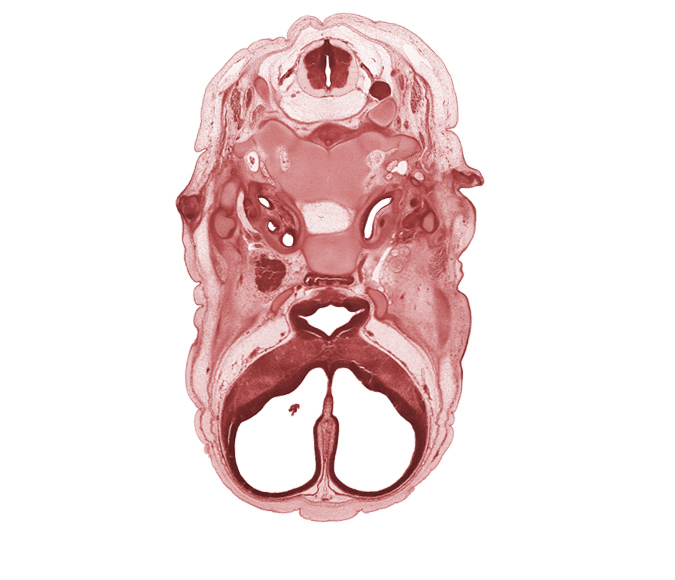 C-2 dorsal root, C-2 spinal ganglion, accessory nerve (CN XI), adenohypophysis, atlanto-occipital joint, auricle, body of sphenoid, cerebral vesicle (hemisphere), cochlear duct, edge of choroid plexus, falx cerebri region, geniculate ganglion (CN VII), glossopharyngeal nerve (CN IX), head mesenchyme, horizontal part of facial nerve (CN VII), internal carotid artery, junction of internal carotid and posterior communicating arteries, lateral ventricle, neural arch of C-1 vertebra (atlas), notochord, optic chiasma (chiasmatic plate), orbitosphenoid, osteogenic layer, sulcus limitans, surface ectoderm, temporalis muscle, vagus nerve (CN X), venous plexus(es)