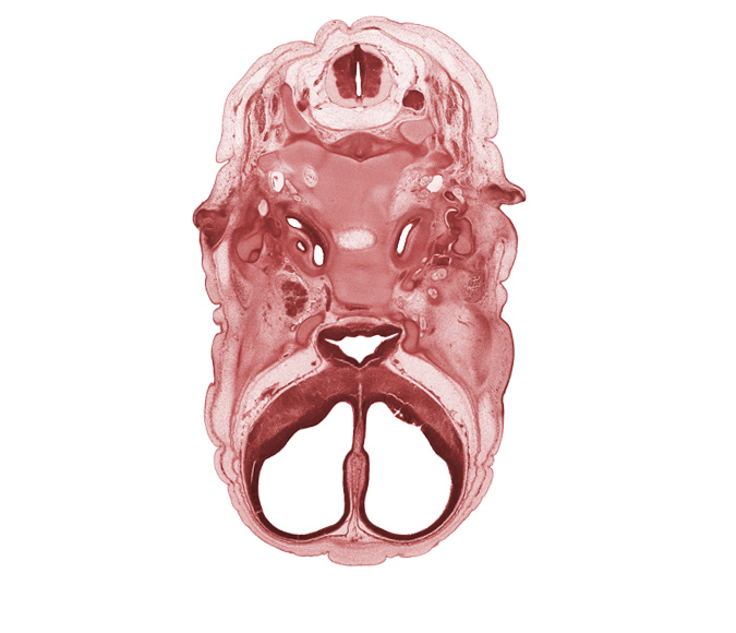 C-2 spinal ganglion, anterior cerebral artery, basi-occipital (basal plate), body of sphenoid, caudal edge of cranial cavity, central canal, cephalic edge of dens of C-2 vertebra (axis), cervical plexus, chorda tympani nerve, cochlear duct, falx cerebri region, hypoglossal canal, hypoglossal nerve (CN XII), internal carotid artery, lateral ventricle, mandibular nerve (CN V₃), maxillary nerve (CN V₂), ophthalmic nerve (CN V₁), optic chiasma (chiasmatic plate), orbitosphenoid, subarachnoid space, third ventricle