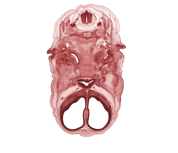 C-2 spinal ganglion, C-2 spinal nerve, alisphenoid, anterior cerebral artery, auricle, body of sphenoid, dens of C-2 vertebra (axis), edge of eyeball, facial nerve (CN VII), frontalis muscle, internal carotid artery, notochord, optic groove, orbitosphenoid, osteogenic layer, pharyngotympanic tube, pre-optic area, spinal accessory nerve (CN XI), subarachnoid space, vagus nerve (CN X), ventral arch of C-1 vertebra (atlas)