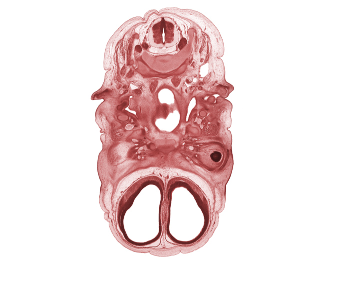 C-3 spinal ganglion, anterior cerebral artery, artifact space(s), auricle, body of sphenoid, cephalic edge of pharynx, dura mater, ear ossicle condensation, edge of pigmented layer of retina, extrinsic ocular muscle(s), grey matter, internal carotid artery, pharyngeal arch 1 cartilage (Meckel), pharyngeal arch 2 cartilage, pharyngotympanic tube, subarachnoid space, sympathetic trunk, vagus nerve (CN X), vascular plexus, venous plexus (superior sagittal sinus region), white matter