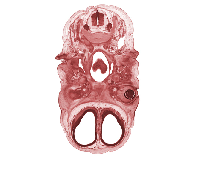 C-3 spinal ganglion, anterior communicating artery, cerebral vesicle (hemisphere), cornea, dorsal horn of grey matter, dorsal root(s), dorsum of tongue, ear ossicle condensation, edge of intraretinal space (optic vesicle cavity), facial nerve (CN VII), frontal prominence, frontalis muscle, inferior ganglion of vagus nerve (CN X), infra-orbital lamina (facial muscle blastemata), lateral ventricle, lower eyelid, mandibular nerve (CN V₃), masseter muscle, osteogenic layer, otic ganglion, pterygopalatine ganglion, spinal accessory nerve (CN XI), stem of adenohypophysis, upper eyelid, ventral horn of grey matter