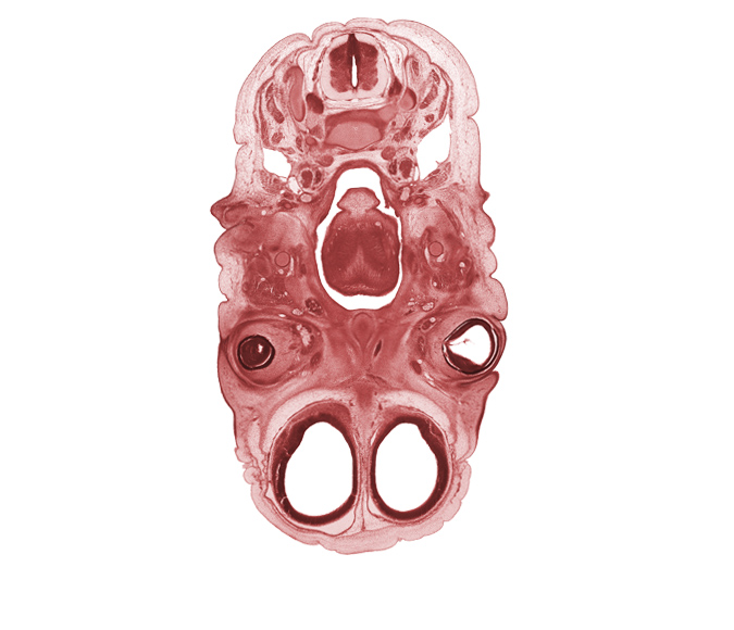 C-3 spinal ganglion, cerebral vesicle (hemisphere), cornea, edge of nasal ectoderm, epiglottis, ethmoid, lateral ventricle, lower eyelid, neural arch of C-3 vertebra, neural layer of retina, pharyngeal arch 1 cartilage (Meckel), pharyngeal arch 2 cartilage, pigmented layer of retina, ramus of mandible, semispinalis capitis muscle, splenius muscle, sternocleidomastoid muscle, subarachnoid space, tongue, trapezius muscle, upper eyelid