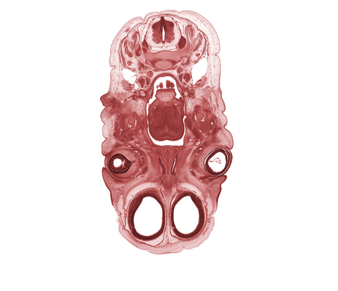 C-3 spinal ganglion, anterior cerebral artery, cephalic edge of arytenoid swelling, cervical plexus, crista galli, extrinsic ocular muscle(s), frontalis muscle, glossopharyngeal nerve (CN IX), intraretinal space (optic vesicle cavity), jugular lymph sac, laryngeal pharynx, lateral ventricle, lingual nerve, nasal cavity (nasal sac), neural arch of C-3 vertebra, olfactory filia (CN I), optic nerve (CN II), oronasal cavity, pharyngeal arch 1 cartilage (Meckel), sternocleidomastoid muscle