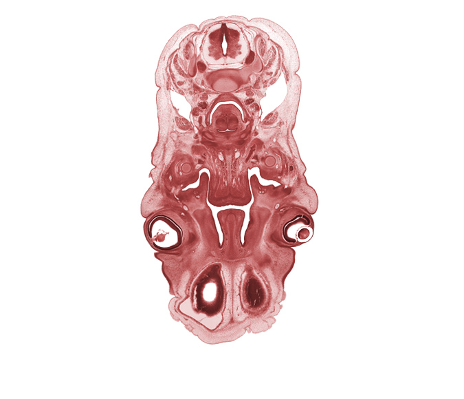 C-3 / C-4 intervertebral disc, C-4 spinal ganglion, cornea, edge of lateral ventricle, extrinsic ocular muscle(s), greater horn of hyoid (pharyngeal arch 3 cartilage), hyaloid vessel(s), hypoglossal nerve (CN XII), internal carotid artery, intraretinal space (optic vesicle cavity), lens, mandible, masseter muscle, middle pharyngeal constrictor muscle, nasal capsule cartilage condensation, olfactory bulb, olfactory epithelium (placode), olfactory filia (CN I), submandibular gland, upper eyelid, vascular plexus