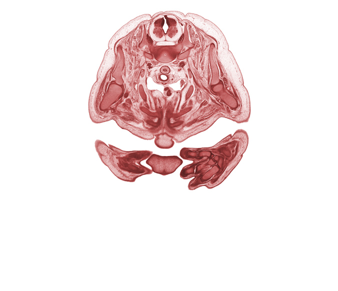 C-6 / C-7 intervertebral disc, T-12 spinal ganglion, alar plate(s), basal plate, brachiocephalic artery, edge of chin, floor plate, head of humerus, head of rib 1, hemisternum, left common carotid artery, left subclavian artery, metacarpal 3, metacarpophalangeal joint, neural arch, nose, notochord, pectoralis major muscle, pectoralis minor muscle, rib 2, rib 3, roof plate, sulcus limitans, superior vena cava, thymus gland, transverse process