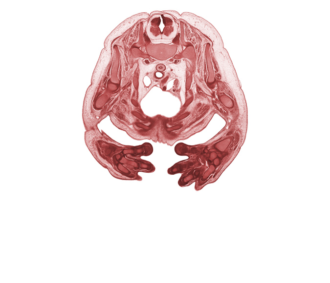 T-1 intercostal nerve, T-1 spinal ganglion, T-1 spinal nerve, brachial artery, brachial plexus, caudal edge of thymus gland, cephalic edge of left pleural cavity, esophagus muscularis, hemisternum, left digit 1 (thumb), lunate, median nerve, metacarpal 2, metacarpal 4, notochord, pericardial cavity, radius, rib 1, rib 2, rib 3, rib 4, rib 5, scapula, subarachnoid space, superior vena cava, trachea