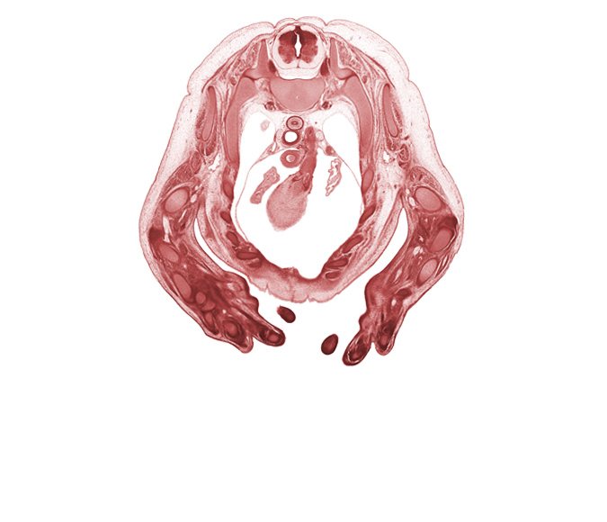 T-2 spinal ganglion, T-2 spinal nerve, apex of right lung, auricle of left atrium, auricle of right atrium, left vagus nerve (CN X), metacarpal 4, neural arch, pleural cavity, pulmonary semilunar valve, pulmonary trunk, radial nerve, radius, rib 2, right ventricle, serratus anterior muscle, superior vena cava, ulna