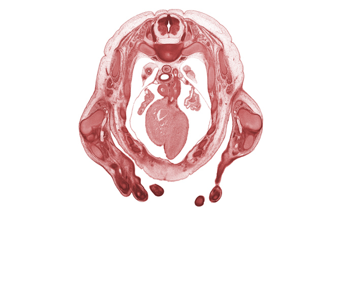 T-2 spinal ganglion, T-3 / T-4 intervertebral disc, auricle of left atrium, auricle of right atrium, ductus arteriosus, interventricular sulcus, left ventricle, rhomboid major muscle, rib 3, right ventricle, subarachnoid space, superior vena cava, sympathetic trunk, ulna, ulnar nerve