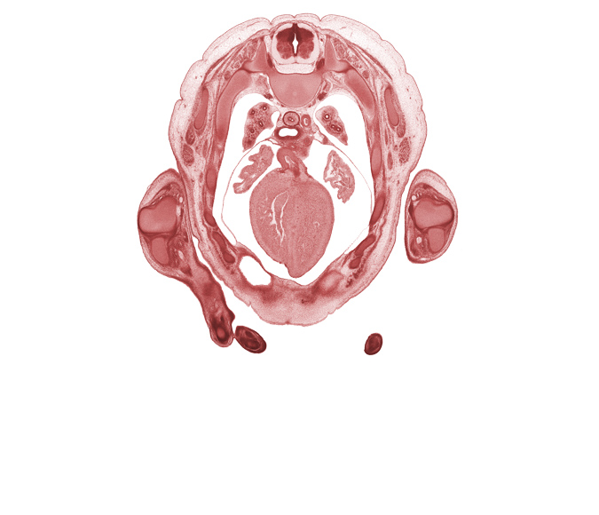 T-3 spinal ganglion, auricle of left atrium, auricle of right atrium, central tendon of diaphragm, cephalic edge of peritoneal cavity, left hand, left ventricle, neural arch, pericardial cavity, right vagus nerve (CN X), sympathetic trunk, trabecular part of right ventricle, tracheal bifurcation, transverse process, ulna, ulnar nerve, upper lobe of left lung, upper lobe of right lung