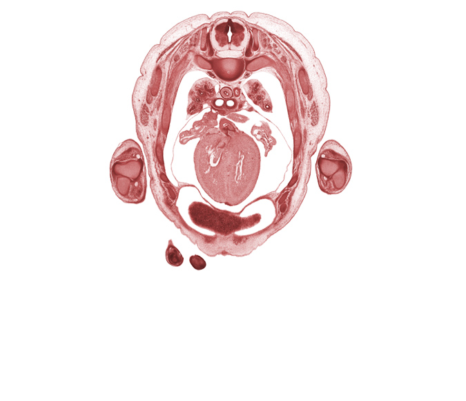 T-3 spinal ganglion, aorta, auricle of left atrium, auricle of right atrium, cephalic edge of liver, digits (fingers), extensor muscles in forearm, head of rib 4, iliocostalis muscle, junction of right atrium and superior vena cava, longissimus muscle, muscular interventricular septum, primary bronchus, spinalis muscle, trabecular part of left ventricle, trabecular part of right ventricle, ulna, ulnar nerve, upper lobe of left lung, upper lobe of right lung