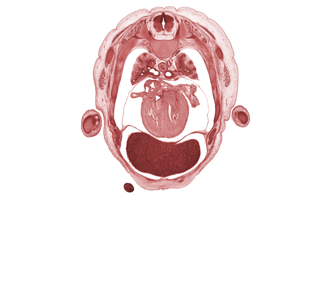 T-4 intercostal nerve, T-4 spinal ganglion, aortic vestibule, auricle of left atrium, azygos vein, digits (fingers), left lobe of liver, left vagus nerve (CN X), pericardial sac, peritoneal cavity, primary bronchus, pulmogenic coat, rhomboid major muscle, right lobe of liver, right vagus nerve (CN X), sinus venosus, trapezius muscle, ulnar nerve, upper lobe of right lung, upper secondary bronchus