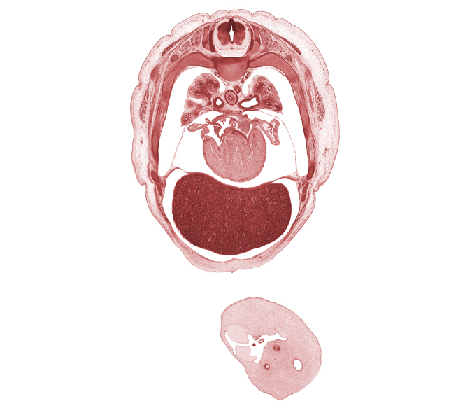 T-4 spinal ganglion, amnion on surface of umbilical cord, auricle of left atrium, central tendon of diaphragm, horizontal fissure, left atrium, left ventricle, liver prominence, middle lobe of right lung, pericardial cavity, pericardial sac, peritoneal cavity, pleural cavity, primary bronchus, rib 5, right atrium, right ventricle, trapezius muscle, umbilical coelom, umbilical cord, umbilical vesicle stalk, upper lobe of right lung, upper secondary bronchus