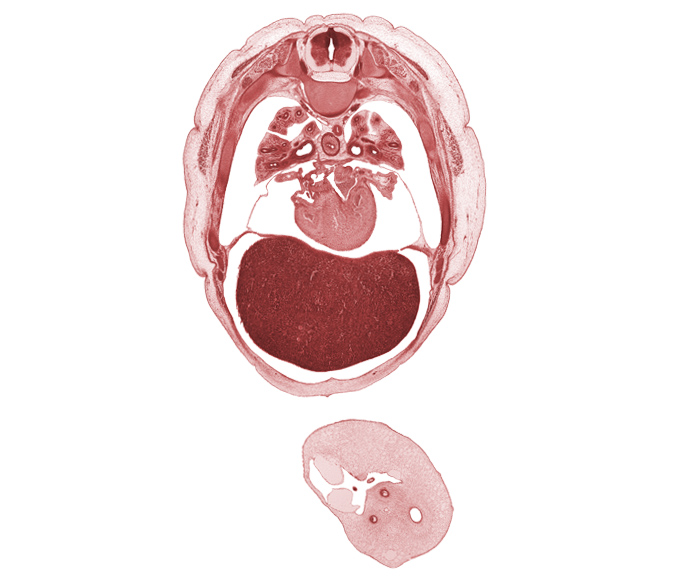 T-5 intercostal nerve, T-5 spinal ganglion, T-5 spinal nerve, horizontal fissure, left ventricle, lower secondary bronchus, middle lobe of right lung, middle secondary bronchus, pericardial sac, primary interatrial septum (septum primum), rib 6, rib 7, right ventricle, secondary interatrial foramen (foramen secundum), secondary interatrial septum (septum secundum), sinus venosus, umbilical coelom, umbilical cord, umbilical vesicle stalk, upper lobe of right lung