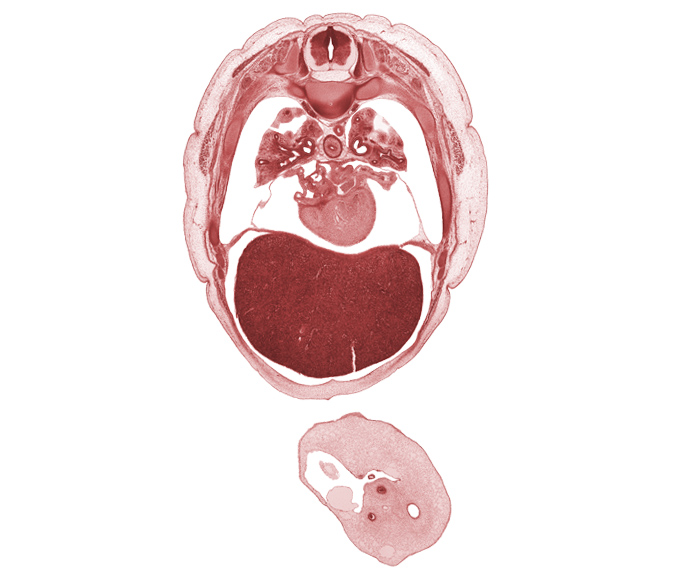 T-5 spinal ganglion, artifact separation(s), caudal edge of scapula, head of rib 6, left lobe of liver, left upper pulmonary vein, lower lobe of left lung, middle lobe of right lung, neural arch, oblique fissure, pericardial cavity, pleural recess, right lobe of liver, secondary interatrial septum (septum secundum), trapezius muscle, umbilical coelom, umbilical cord, umbilical vesicle stalk, upper lobe of left lung