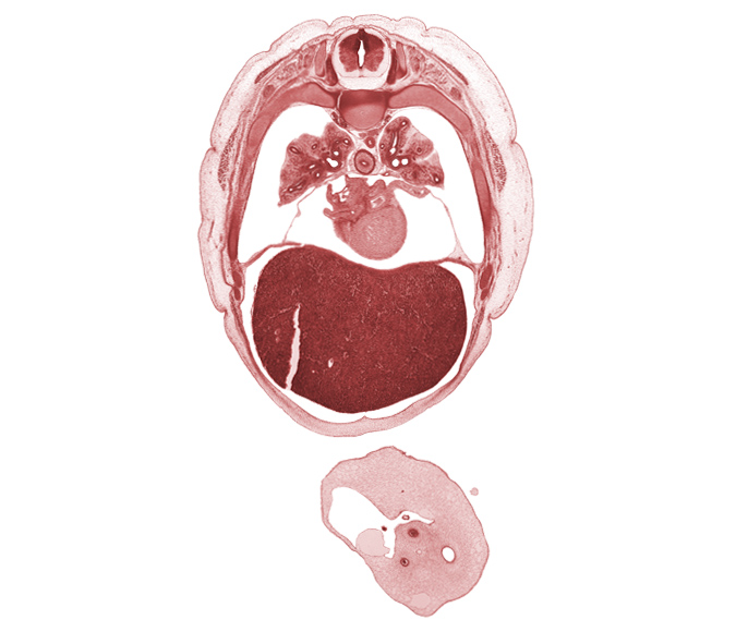 T-5 spinal ganglion, allantois, amnion on surface of umbilical cord, aorta, apex of heart, artifact separation(s), esophagus, latissimus dorsi muscle, left atrium, left lobe of liver, left lower pulmonary vein, left umbilical artery, left ventricle, lower secondary bronchus, oblique pericardial sinus, rib 6, rib 7, rib 8, rib 9, right lobe of liver, right umbilical artery, trapezius muscle, umbilical vein