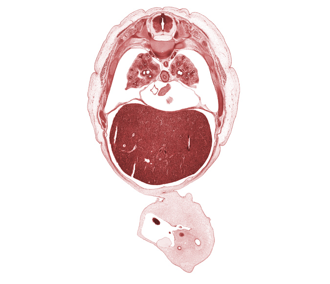 S-1 spinal nerve, T-6 spinal ganglion, allantois, artifact separation(s), caudal edge of left ventricle, caudal edge of right atrium, central tendon of diaphragm, edge of herniated midgut, head of rib 7, inferior vena cava, junction of abdominal wall and umbilical cord, left lobe of liver, left umbilical artery, lower lobe of left lung, lower lobe of right lung, lower secondary bronchus, muscular part of diaphragm, pericardial cavity, peritoneal cavity, pleural cavity, right lobe of liver, right lower pulmonary vein, right umbilical artery, sympathetic trunk, umbilical vein