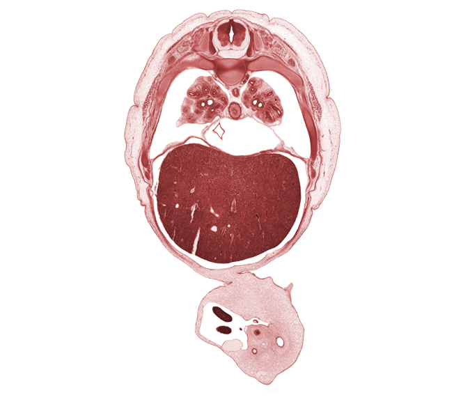 T-6 spinal ganglion, artifact separation(s), distal limb of herniated midgut, edge of herniated midgut, inferior vena cava, left umbilical artery, liver prominence, lower lobe of right lung, pericardial cavity, peritoneal cavity, pleural cavity, pulmogenic coat, rib 7, rib 8, rib 9, right umbilical artery, umbilical cord, umbilical vein