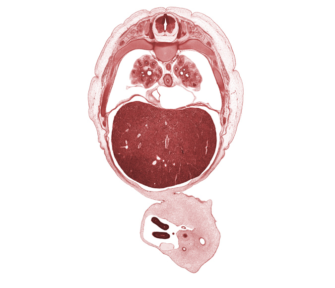 T-6 spinal ganglion, alar plate(s), allantois, basal plate, central tendon of diaphragm, distal limb of herniated midgut, floor plate, inferior vena cava, latissimus dorsi muscle, left lobe of liver, left umbilical artery, left vagus nerve (CN X), lower lobe of right lung, rib 7, rib 8, right lobe of liver, right umbilical artery, roof plate, sulcus limitans, umbilical coelom, umbilical vein, umbilical vesicle stalk