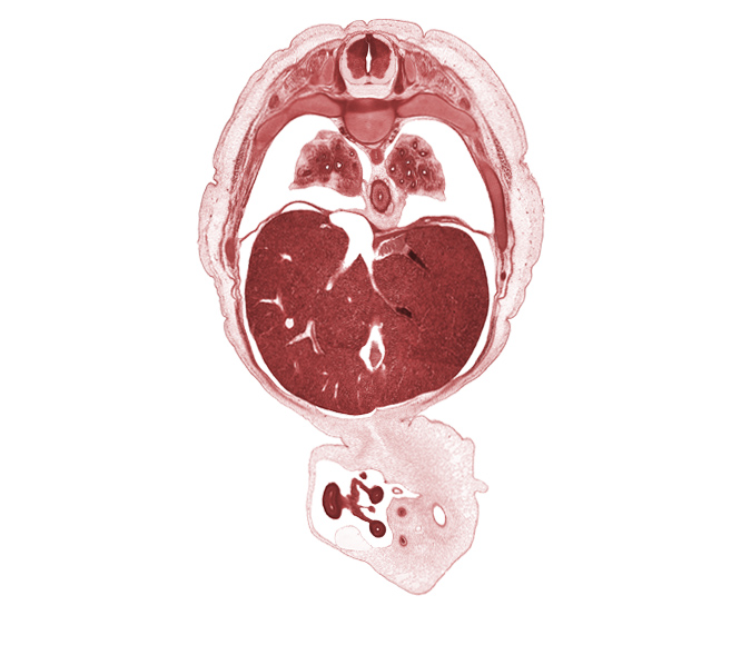 T-7 / T-8 intervertebral disc, T-7 spinal ganglion, diaphragm, distal limb of herniated midgut, edge of ductus venosus, efferent hepatic vein, lower lobe of left lung, lower lobe of right lung, mesentery of herniated midgut, midpoint of herniated midgut, pleural recess, proximal limb of herniated midgut, rib 10, rib 8, rib 9, right lobe of liver, umbilical vesicle stalk